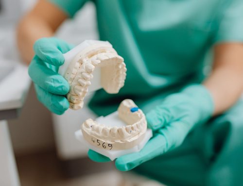 Dental Implants: A Permanent Solution for Missing Teeth